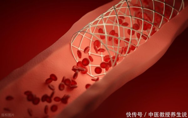 牛股远期策略 高血脂要少吃白菜？医生再三提醒：不想血脂飙升，关键做好这几点